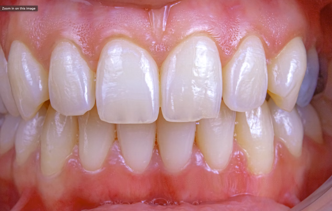 Odontologinės procedūros be skausmo: ar tai įmanoma?